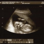 Mid-Pregnancy Scan 1